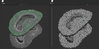 Step_10-11_All_Quads_2.jpg